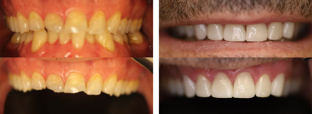 Teeth Repair Smile Gallery