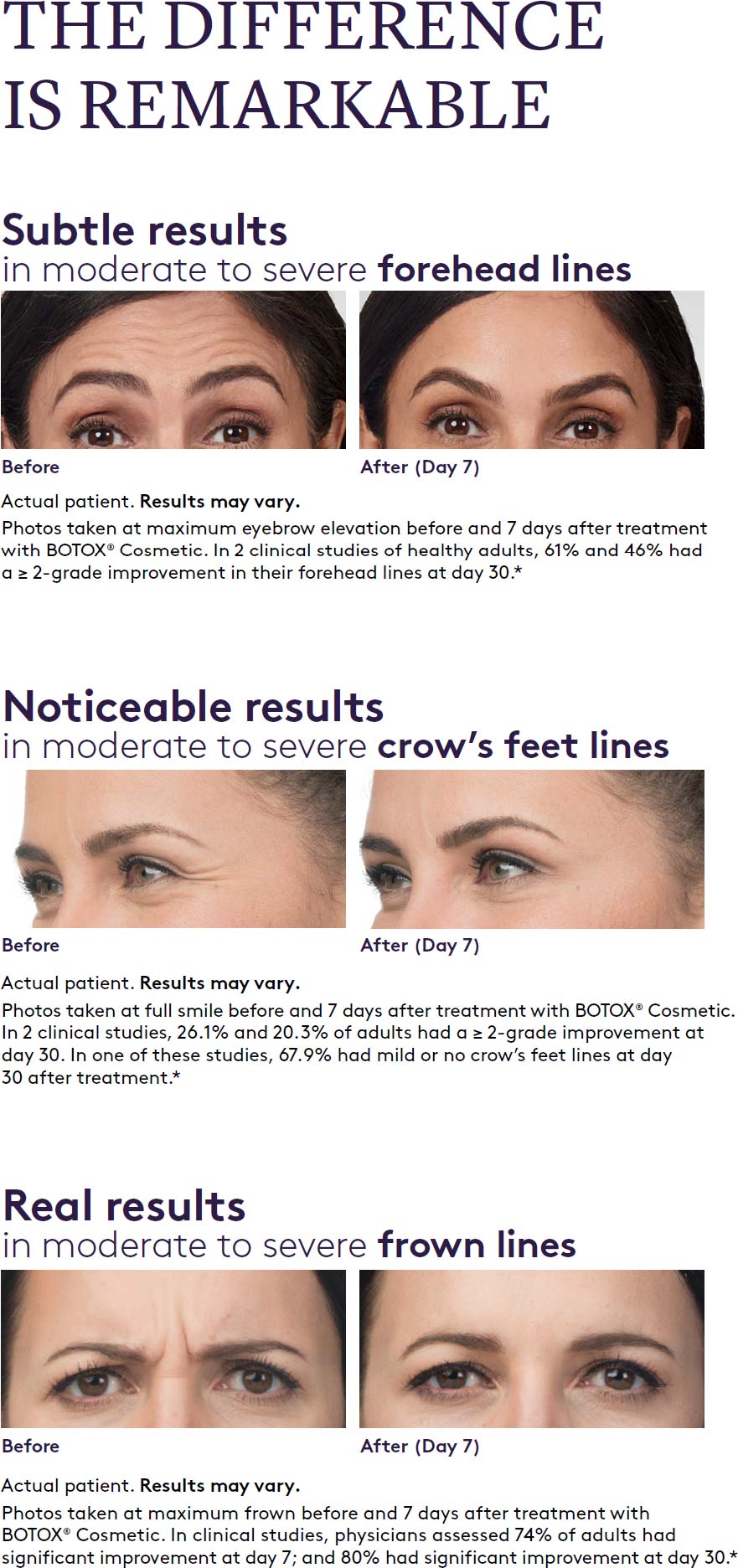 Botox